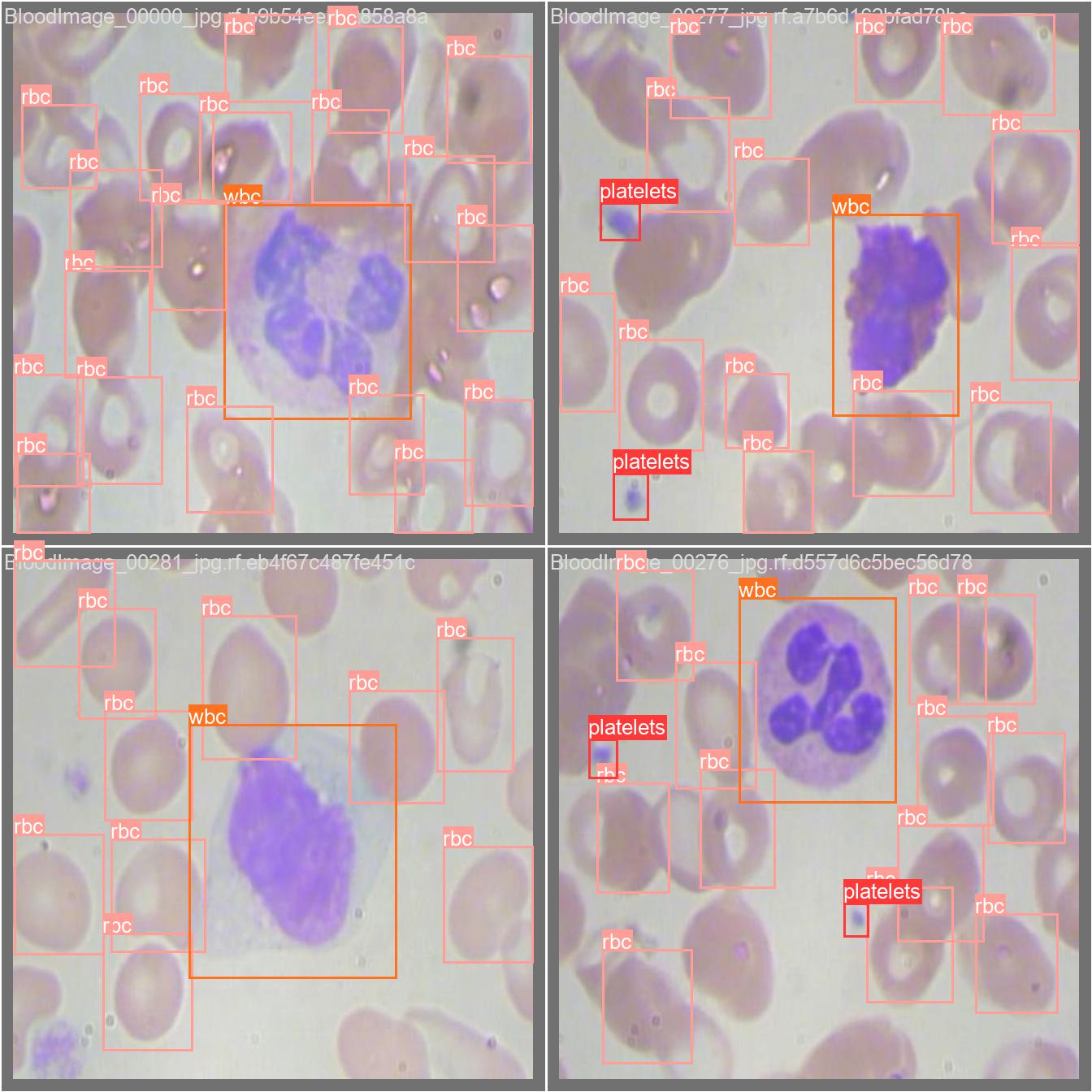 keremberke/yolov5m-blood-cell