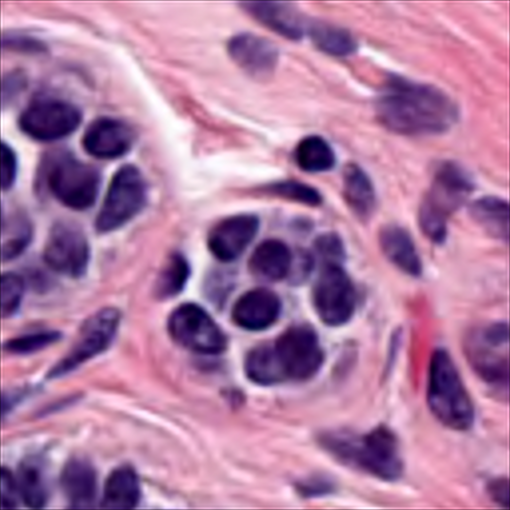 Part_3_226_pathology_breast.png