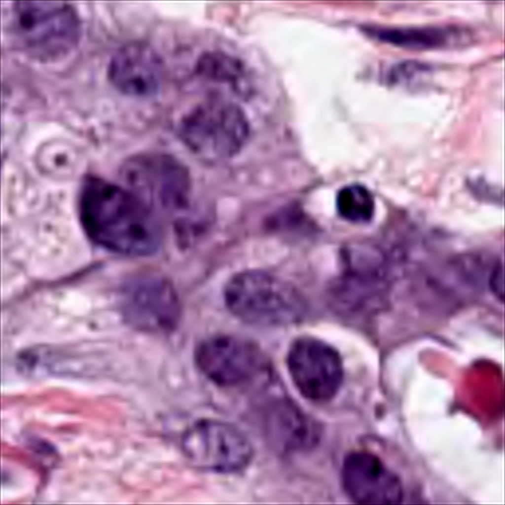 Part_1_516_pathology_breast.png